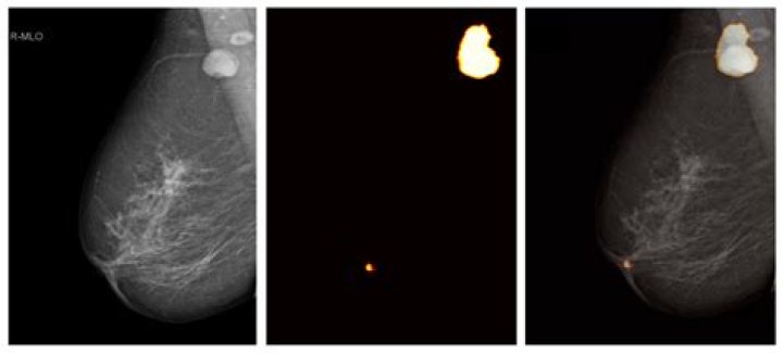 Can I shave my armpits before a mammogram?