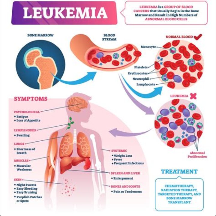 Can leukemia be overlooked?