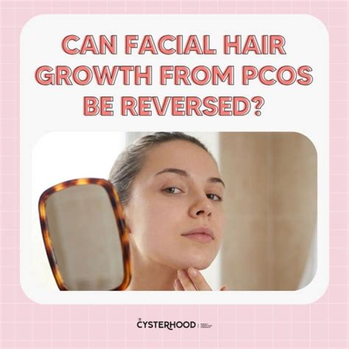 Can you reverse excess hair from PCOS?