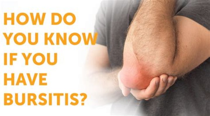 How do you know if bursitis is septic?