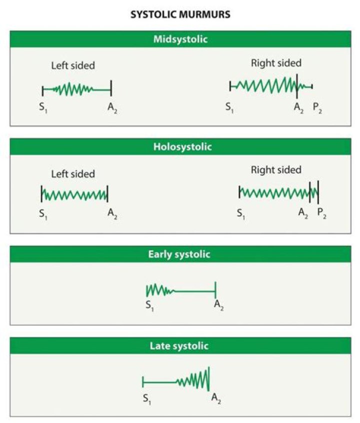 What causes systolic murmur?