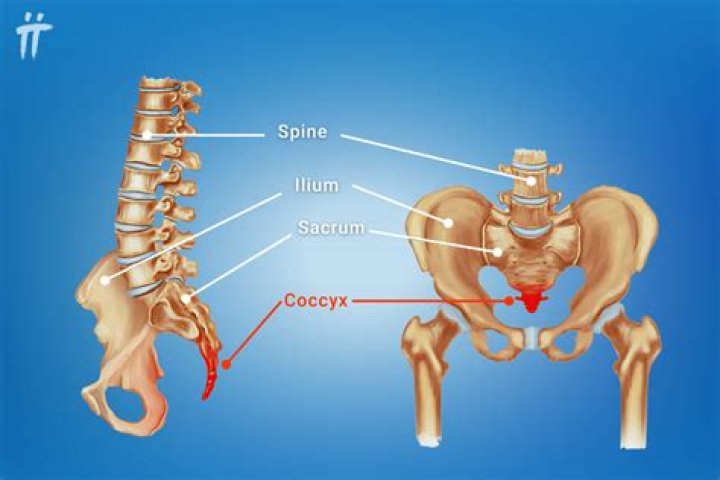 What happens if your coccyx is removed?