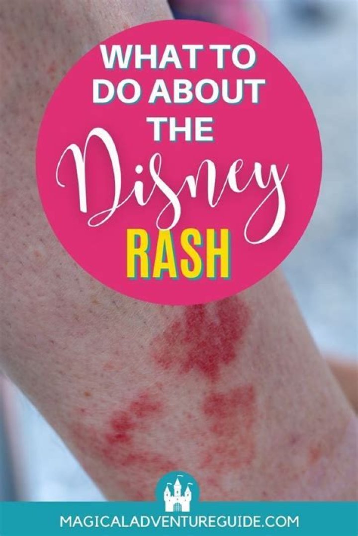 What is Disney rash?
