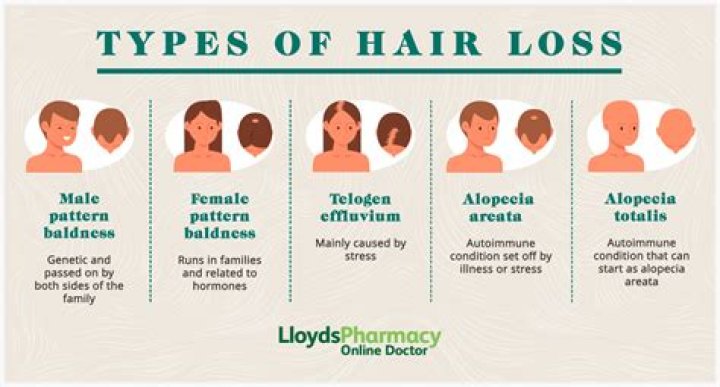 What is the main cause of hair loss?